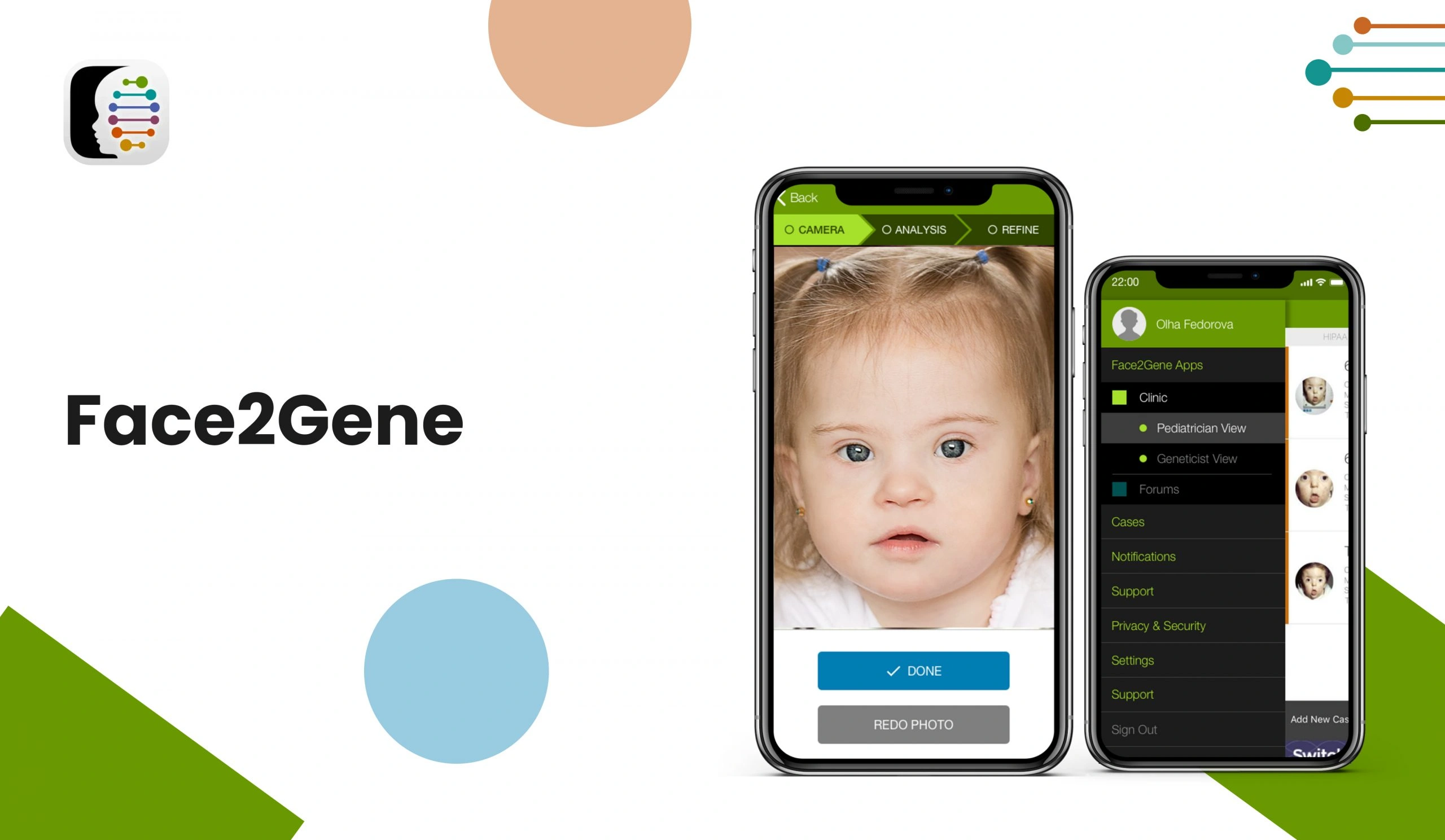 Face2Gene App